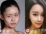 《中國(guó)好聲音》吳玉青花百萬整容變臉Baby